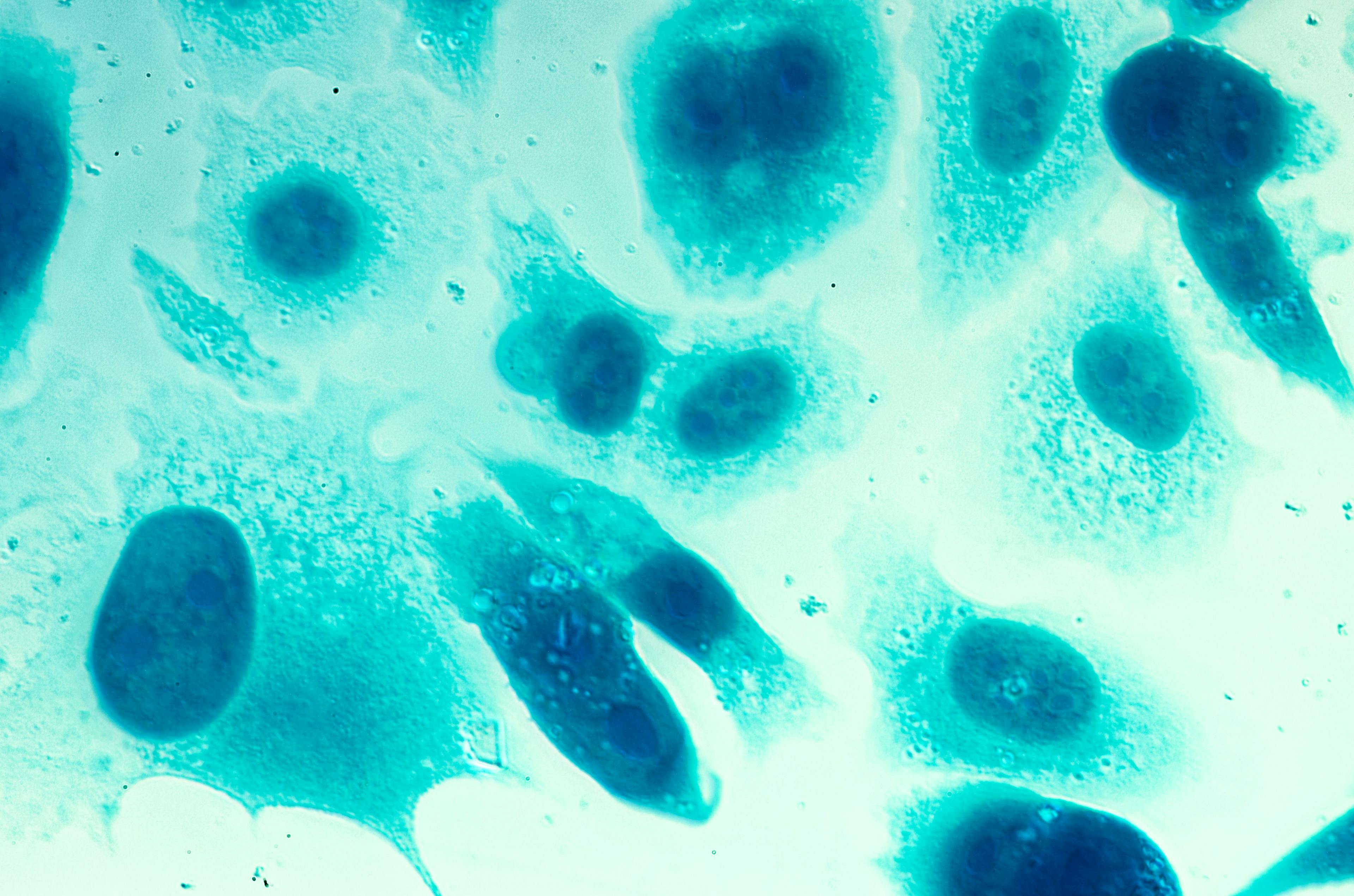 PC-3 human prostate cancer cells| Image Credit: © heitipaves - www.stock.adobe.com