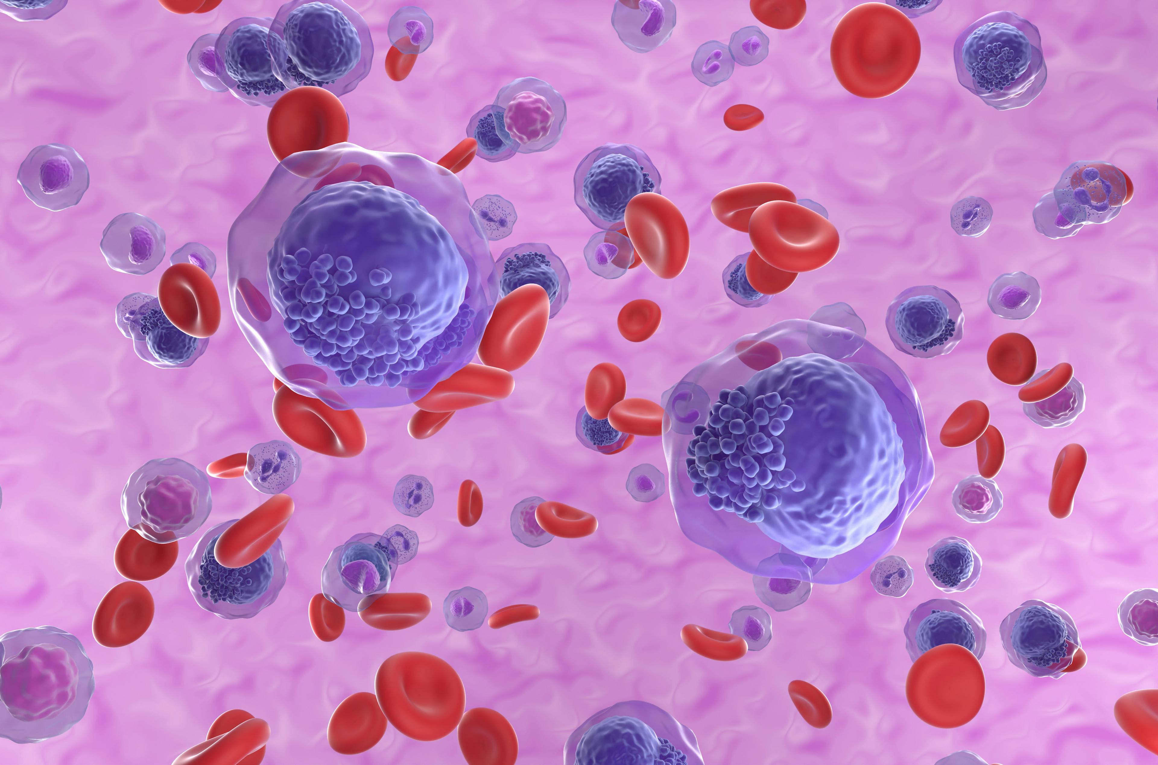 Acute myeloid leukemia cells: © LASZLO - stock.adobe.com