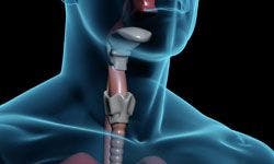Thyroid Cancer Increase in Pennsylvania Provides Clues to Underlying National Surge