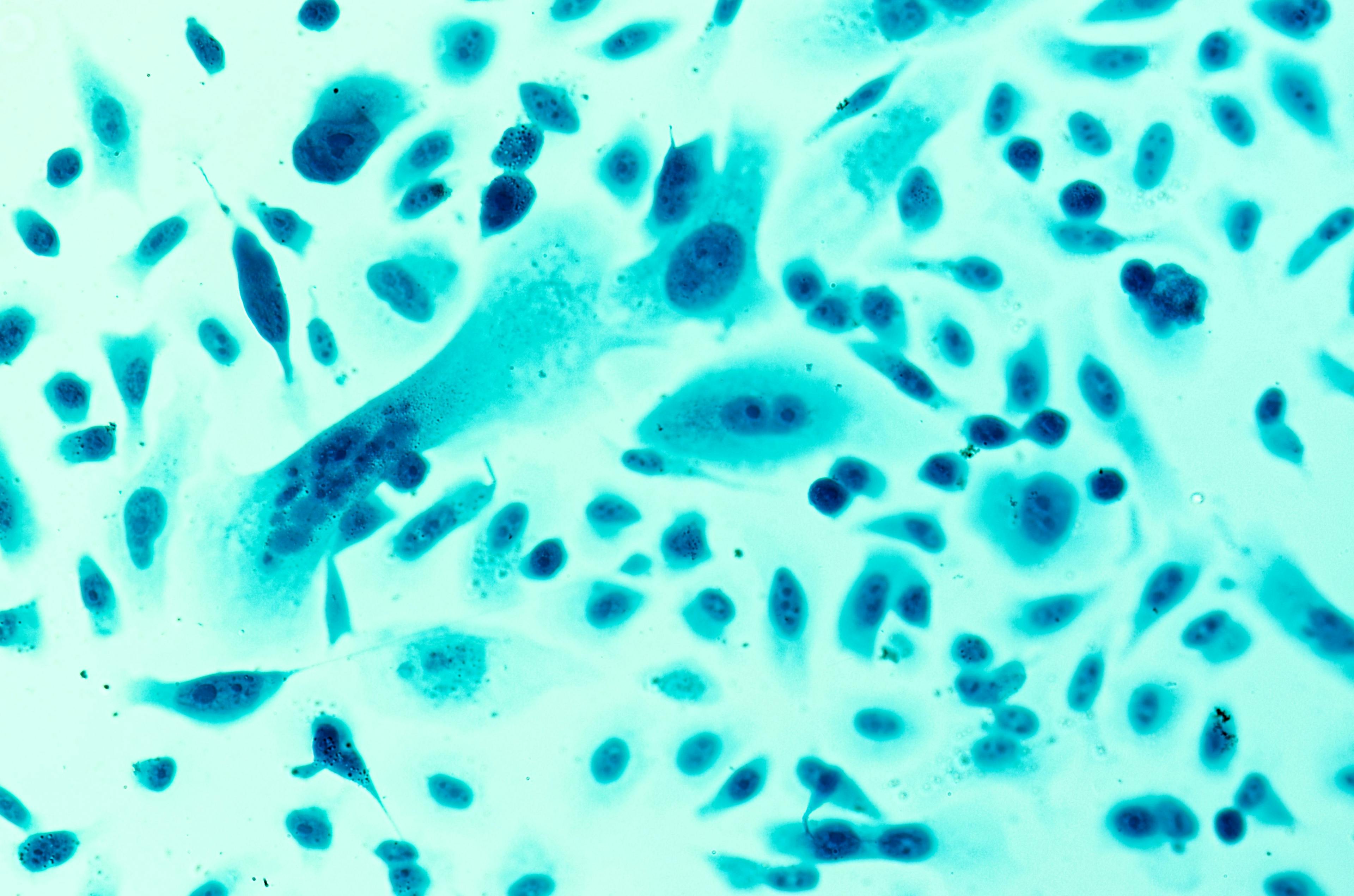 [PC-3 human prostate cancer cells] | Image Credit © [Sheitipaves] - [Adobe Stock]