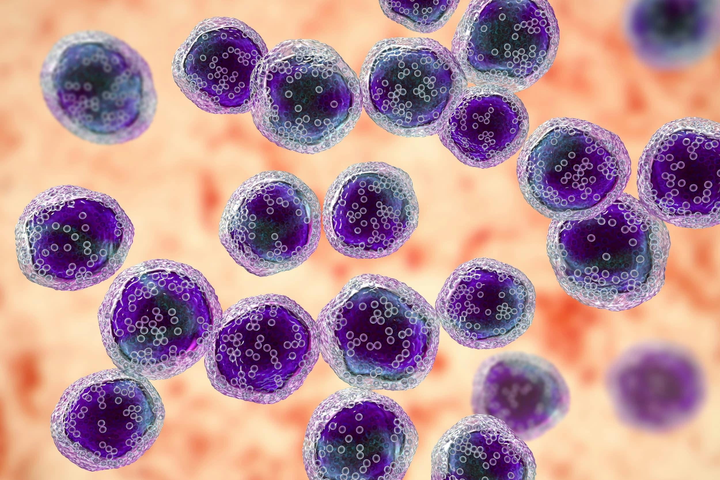 B-cell lymphoma Image credit: © Dr_Microbe via Adobe Stock