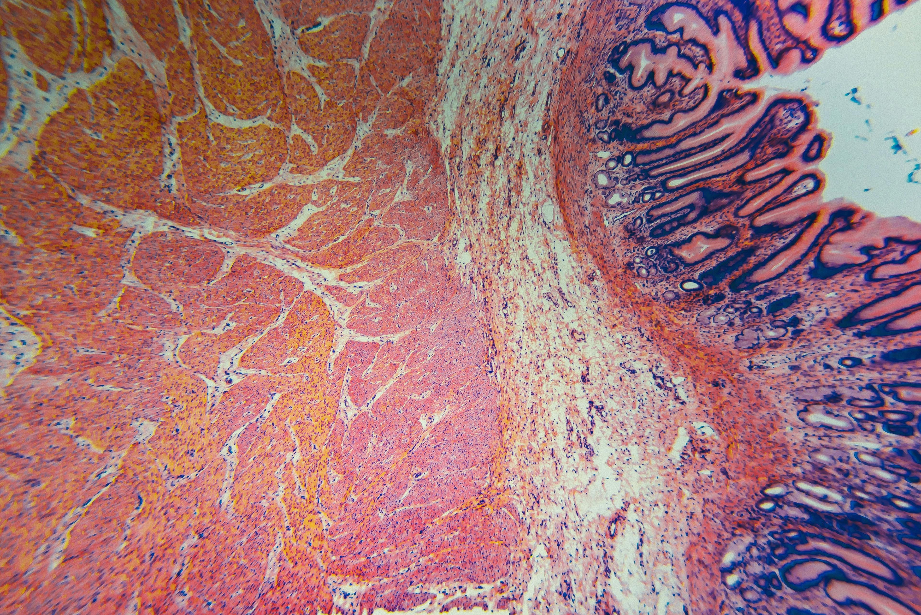 Cell microscopic- pyloric division stomach: © digital photo - stock.adobe.com