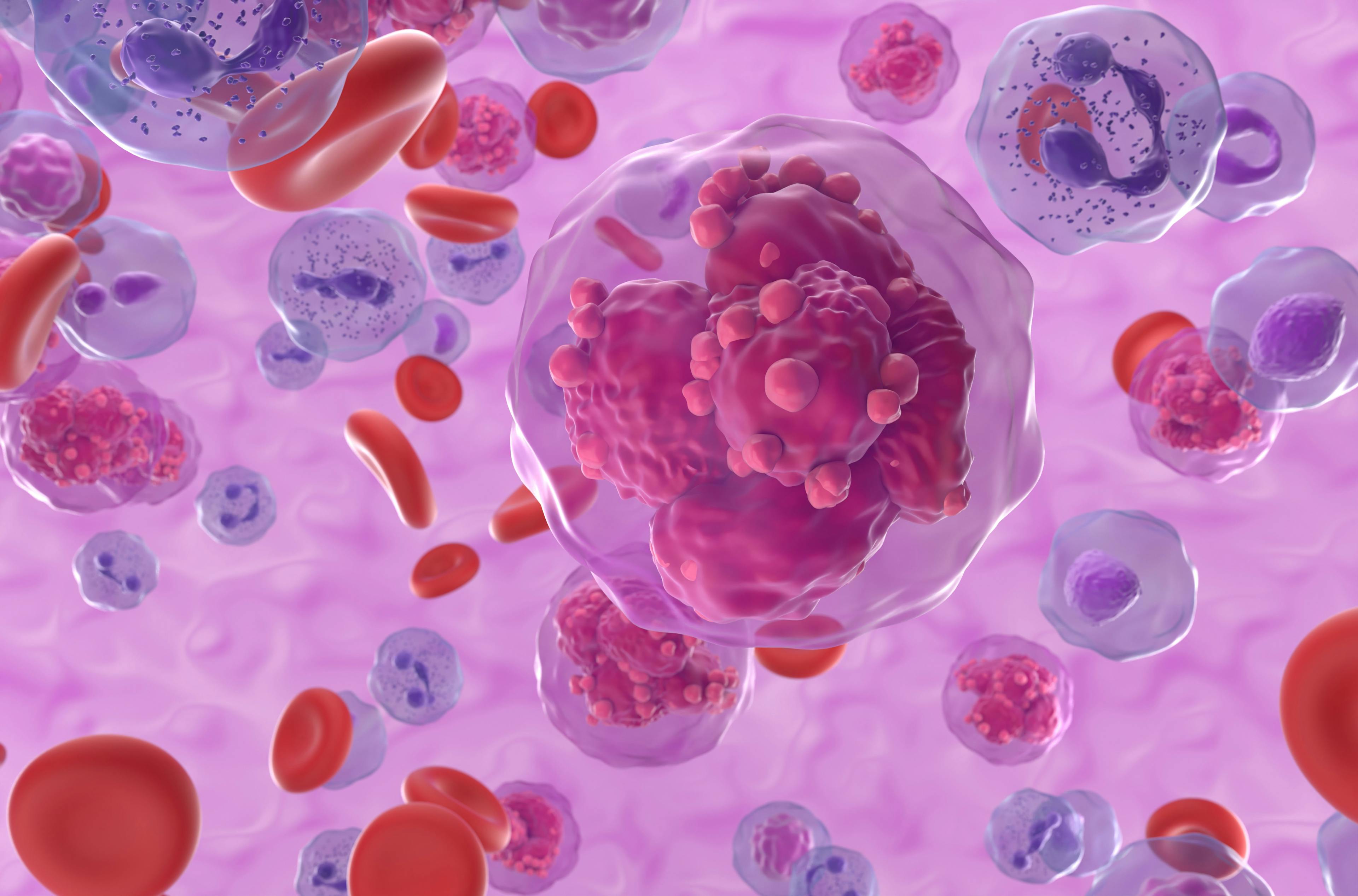 Acute myeloid leukemia (AML) cells in blood flow - isometric view, 3D illustration: © LASZLO - stock.adobe.com