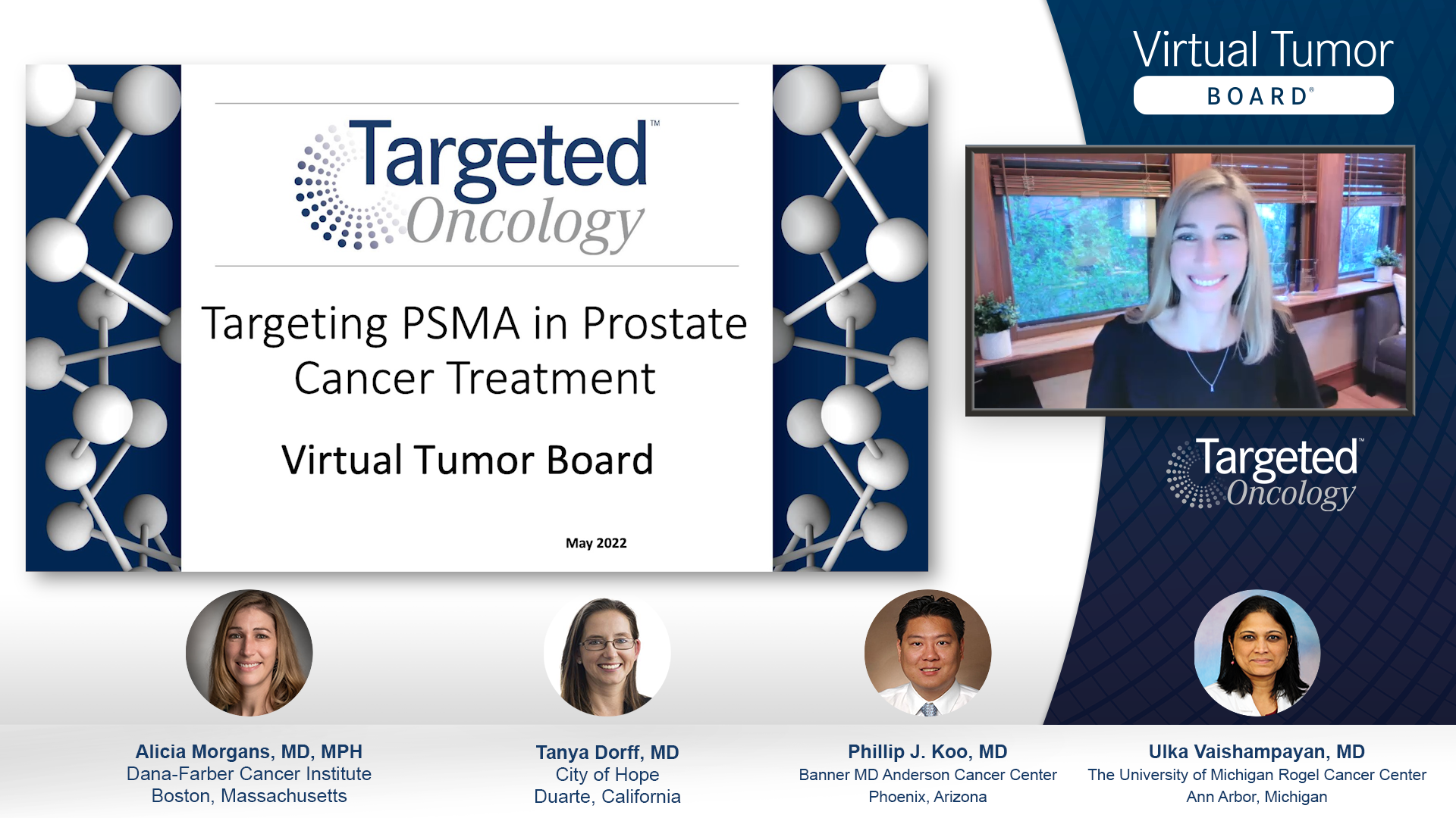 Experts on Prostate Cancer