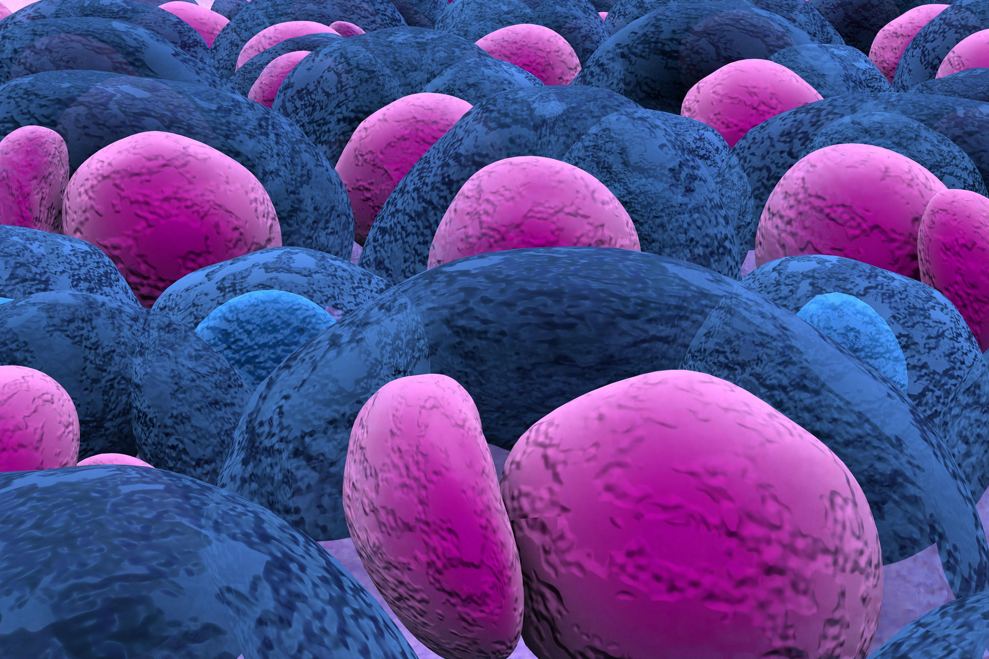 Multiple Myeloma multiplex leukemia cancer 3d color render illustration closeup: © LASZLO - stock.adobe.com