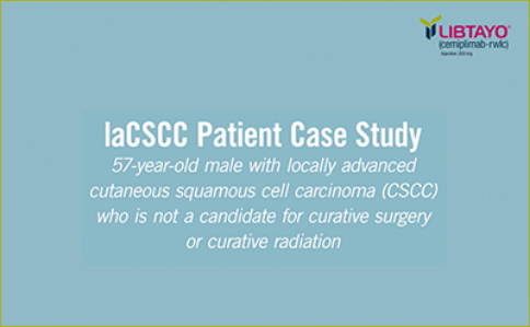 laCSCC Patient Case Study: 57 year old male