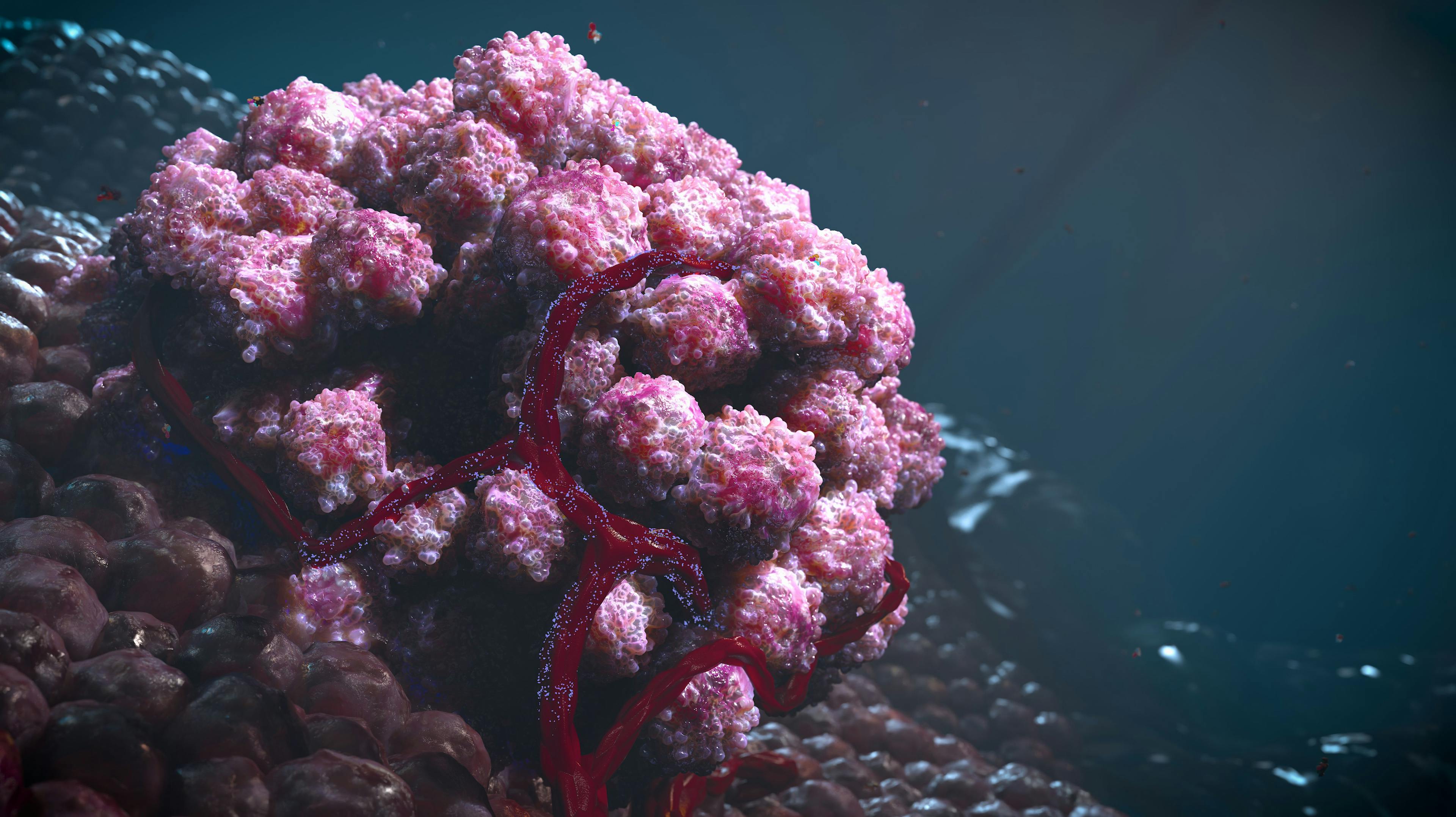Cluster of tumors cells: © Yuriy - stock.adobe.com