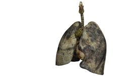 Nanovesicles as Targeted Therapy for Lung Cancer