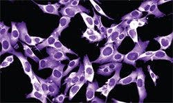 Managing Toxicities in Melanoma