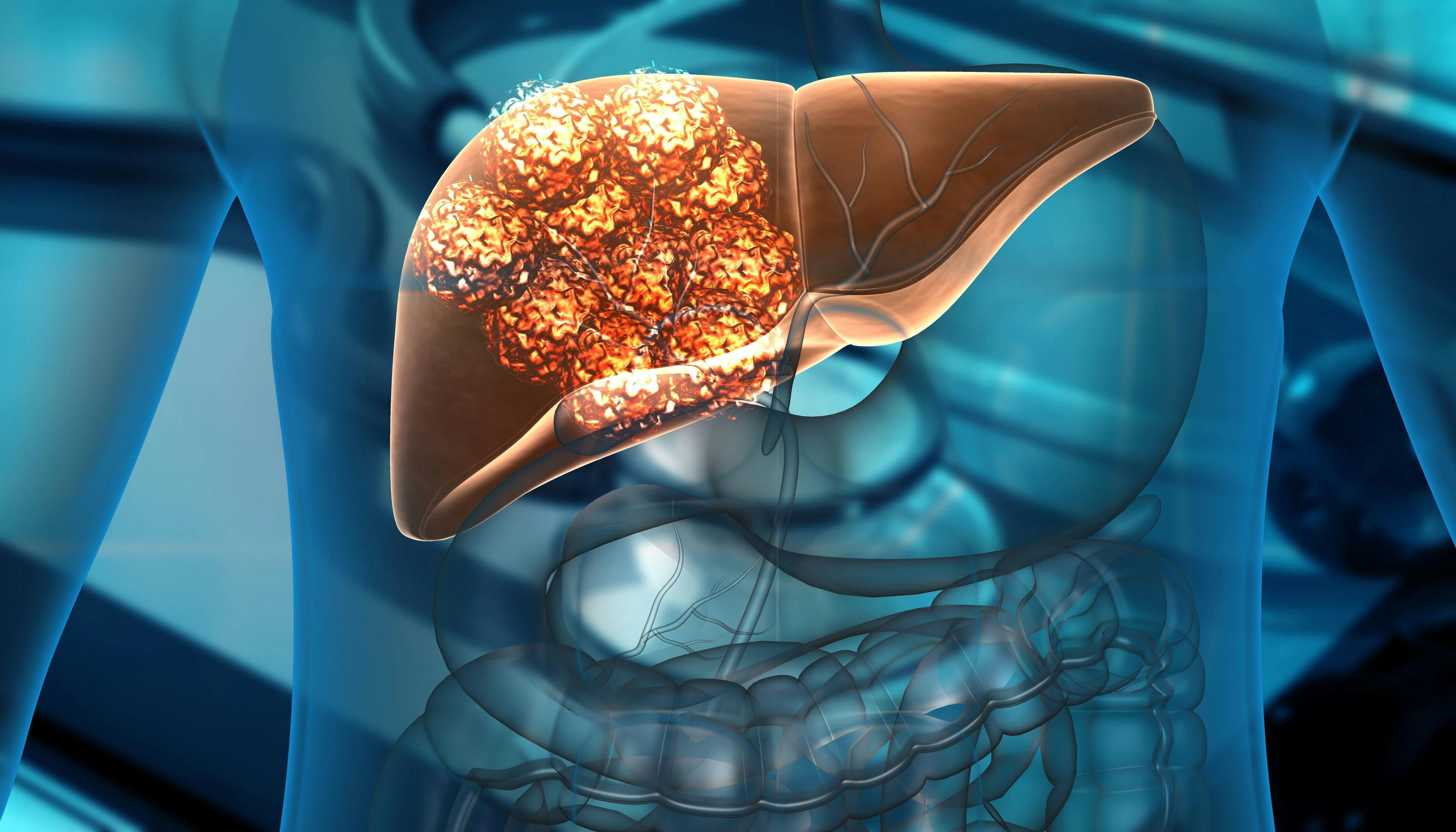 Human liver cancer cell growth. 3d illustration: © Rasi - stock.adobe.com