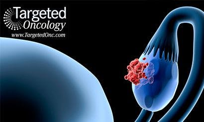 Tumor Growth and Angiogenesis in Ovarian Cancer Linked to Key Adapter Protein