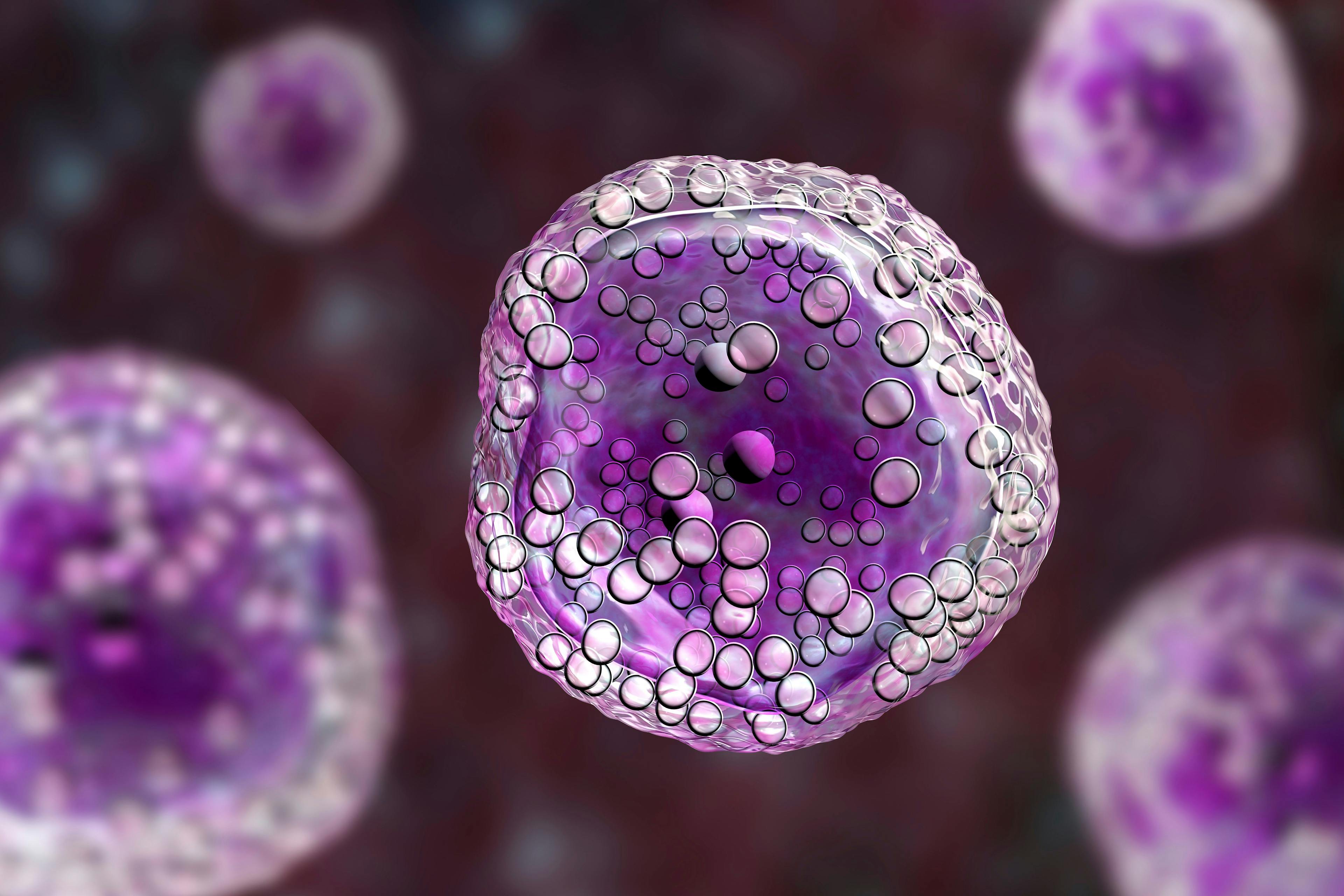 Lymphoma cell, a cancer of the lymphatic system: © Dr_Microbe - stock.adobe.com