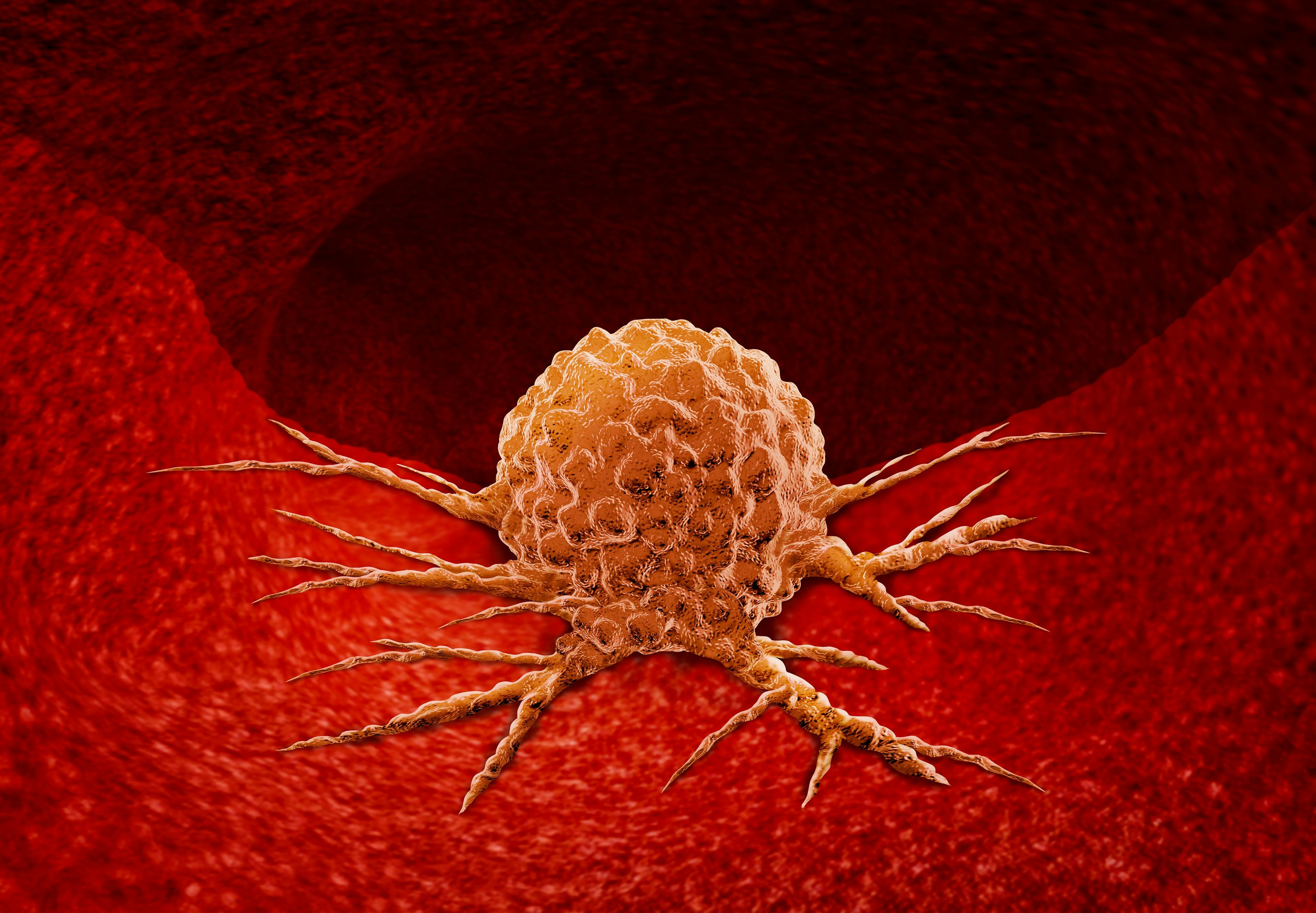 Cancer Anatomy Concept: © freshidea - stock.adobe.com