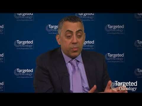 Factors to Consider for Left-Sided Metastatic CRC