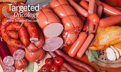 Processed Meats Associated With Colorectal Cancer