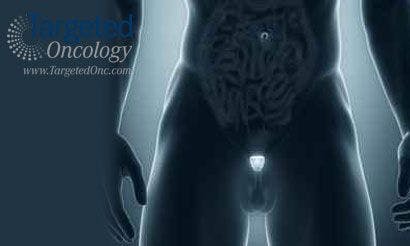 Long-term Study Stresses Importance of Active Surveillance in Low-risk Prostate Cancer