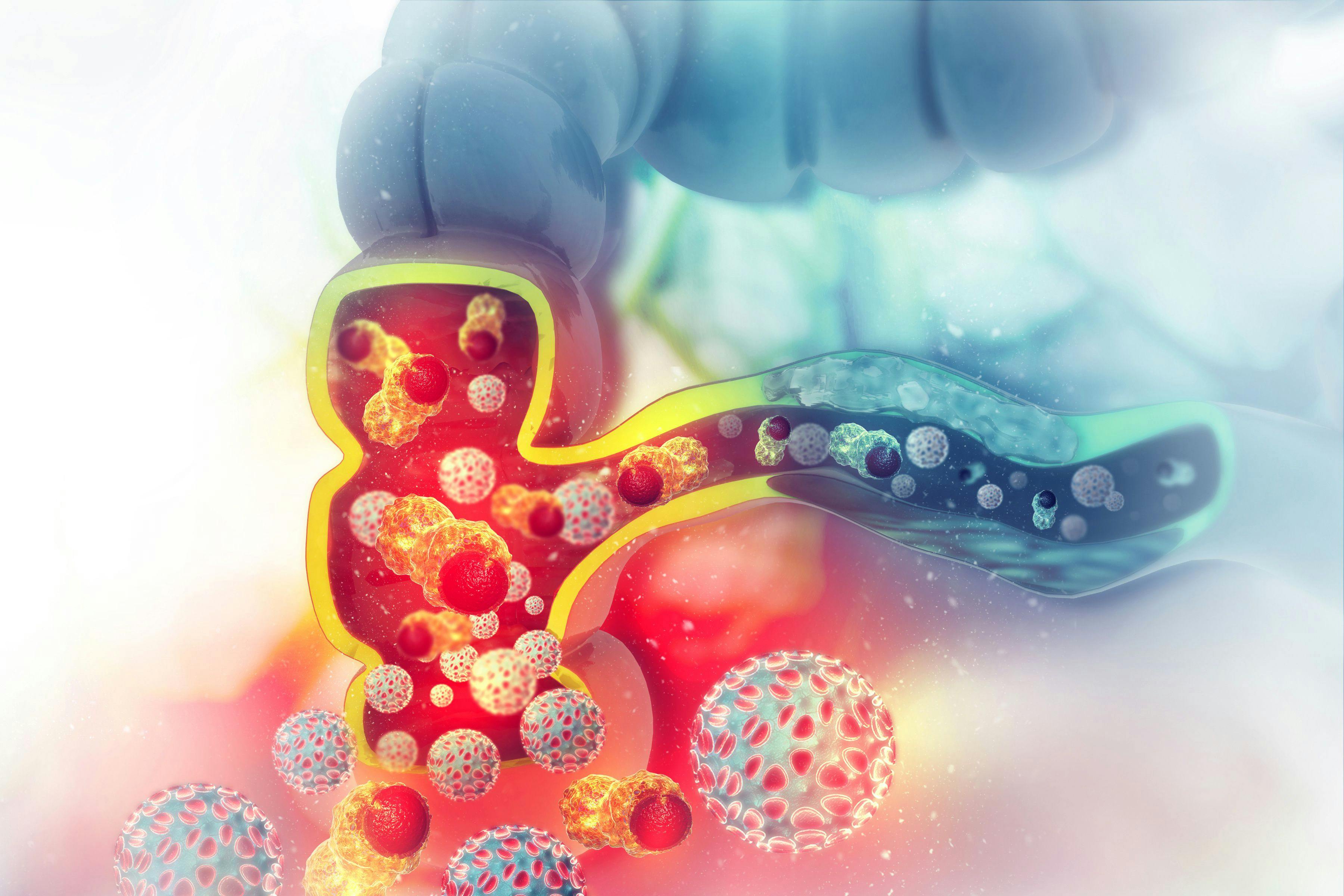 Colon cancer. Cancer attacking cell. Colon disease concept. 3d illustration | Image Credit: © Crystal light - www.stock.adobe.com