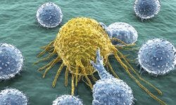 Turning Concept Into Reality: Modulating the Immune System to Treat NSCLC