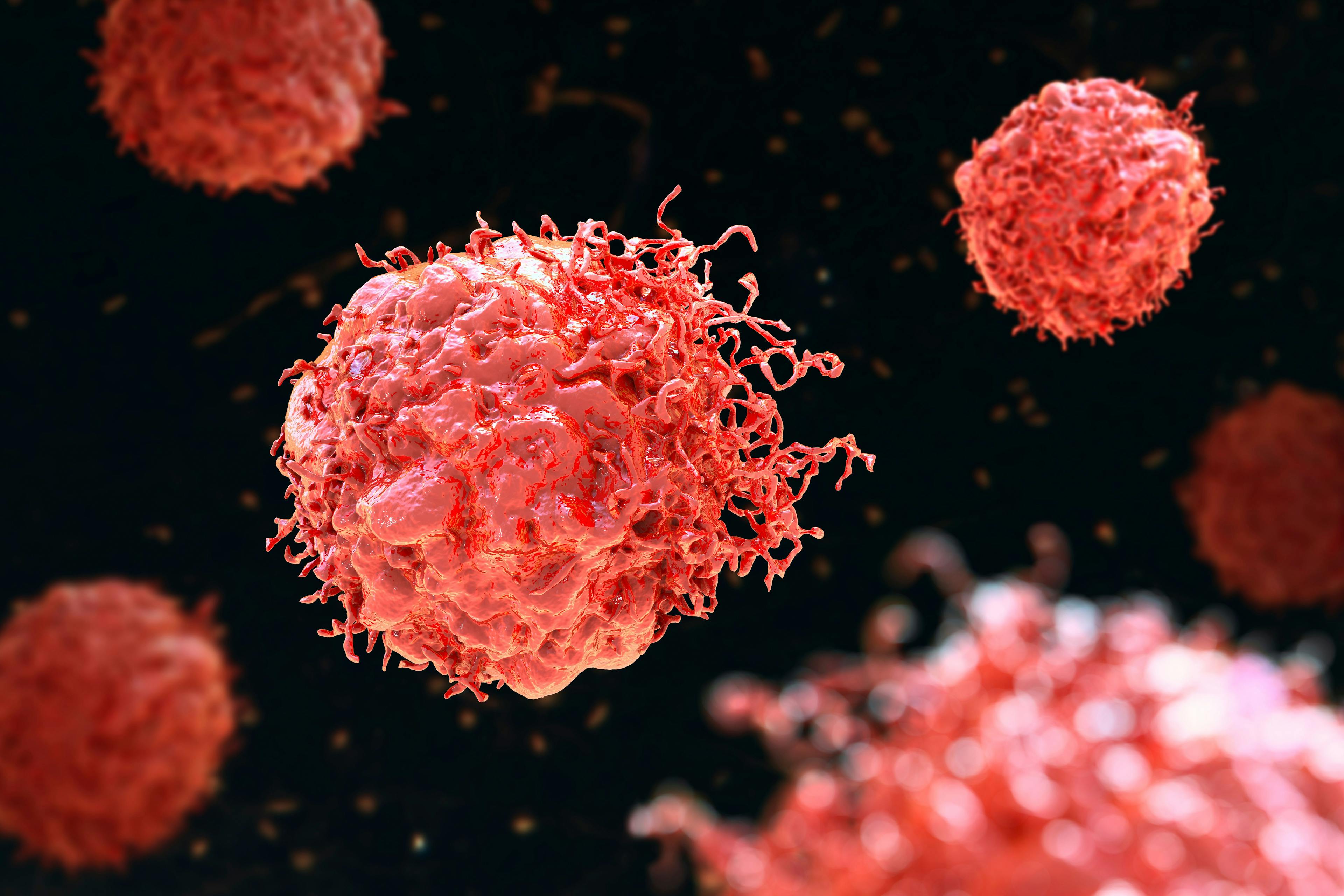 Cancer cells, 3D illustration | Image Credit: © Dr_Microbe - www.stock.adobe.com