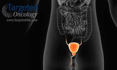 Other Factors Affecting Prognosis and Treatment in Bladder Cancer