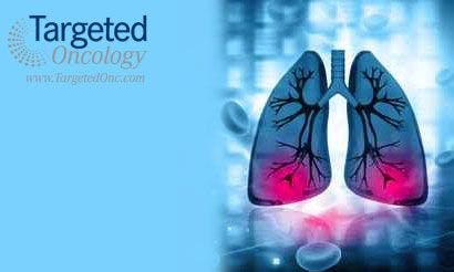 Afatinib Application Accepted by FDA for Squamous Cell Lung Cancer