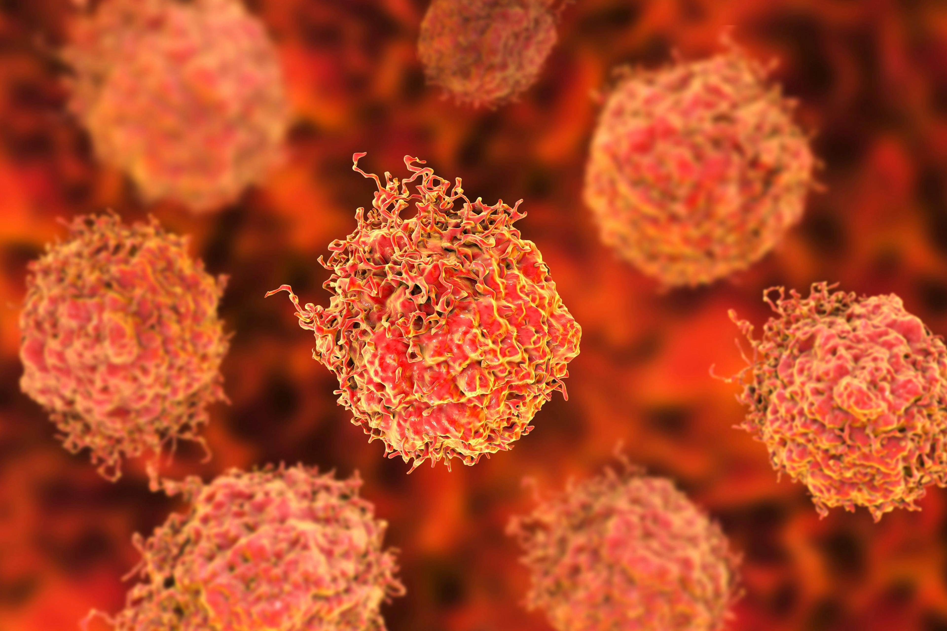 Prostate cancer cells, 3D illustration. Prostate cancer awareness image | Image Credit: © Dr_Microbe -www.stock.adobe.com