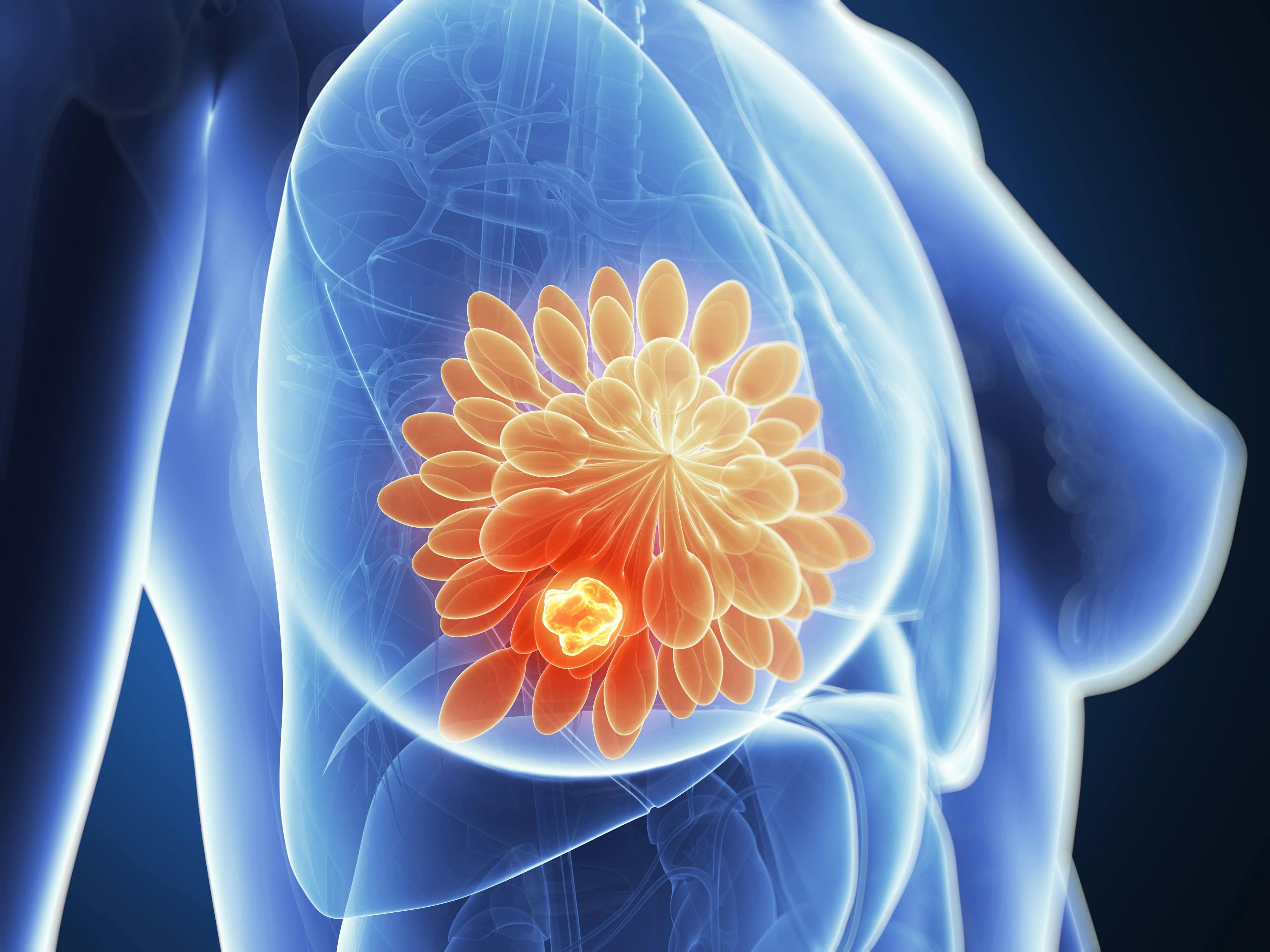 Therapeutic Choices for Patients With HR-Positive, HER2-Low Breast Cancer