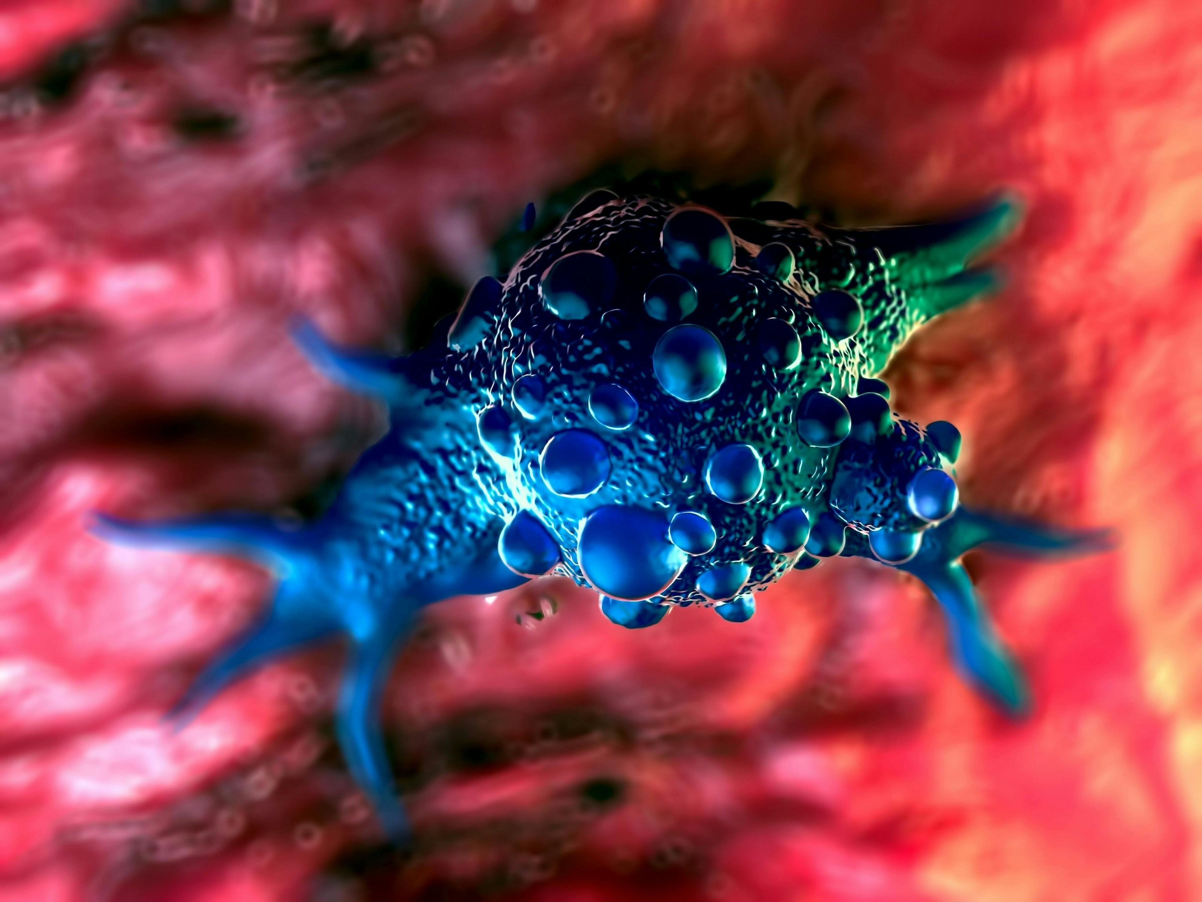 3d illustration - Bladder cancer cells | Image Credit: © PRB ARTS - stock.adobe.com