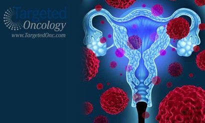 Primary Chemotherapy Before Surgery in Ovarian Cancer May Be Preferable
