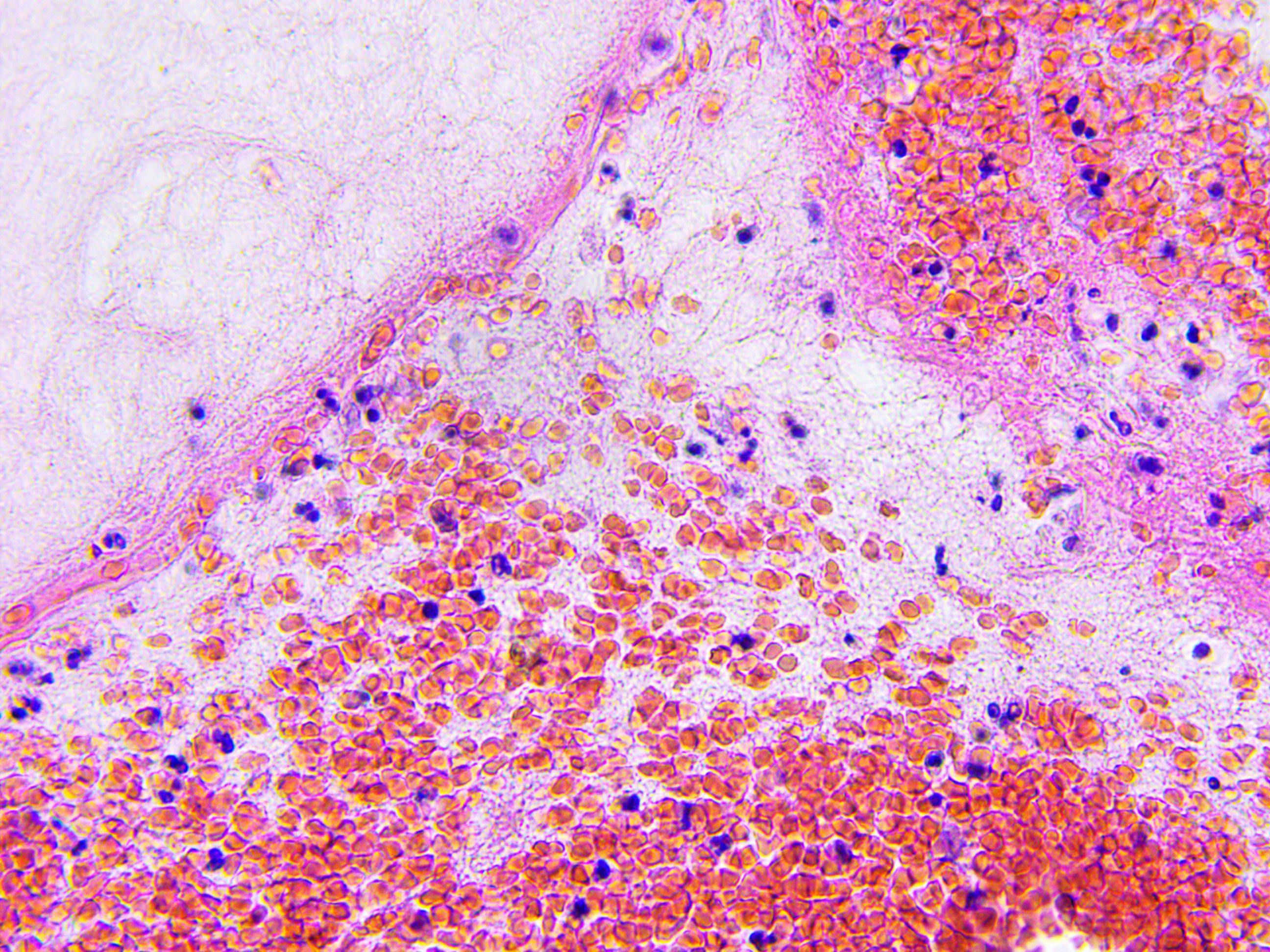 Brain tissue microscopic photography |  | Image Credit: © lukszczepanski - www.stock.adobe.com