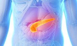 Chemo/SABR Combo May Allow Patients With Advanced Pancreatic Cancer to Undergo Surgery