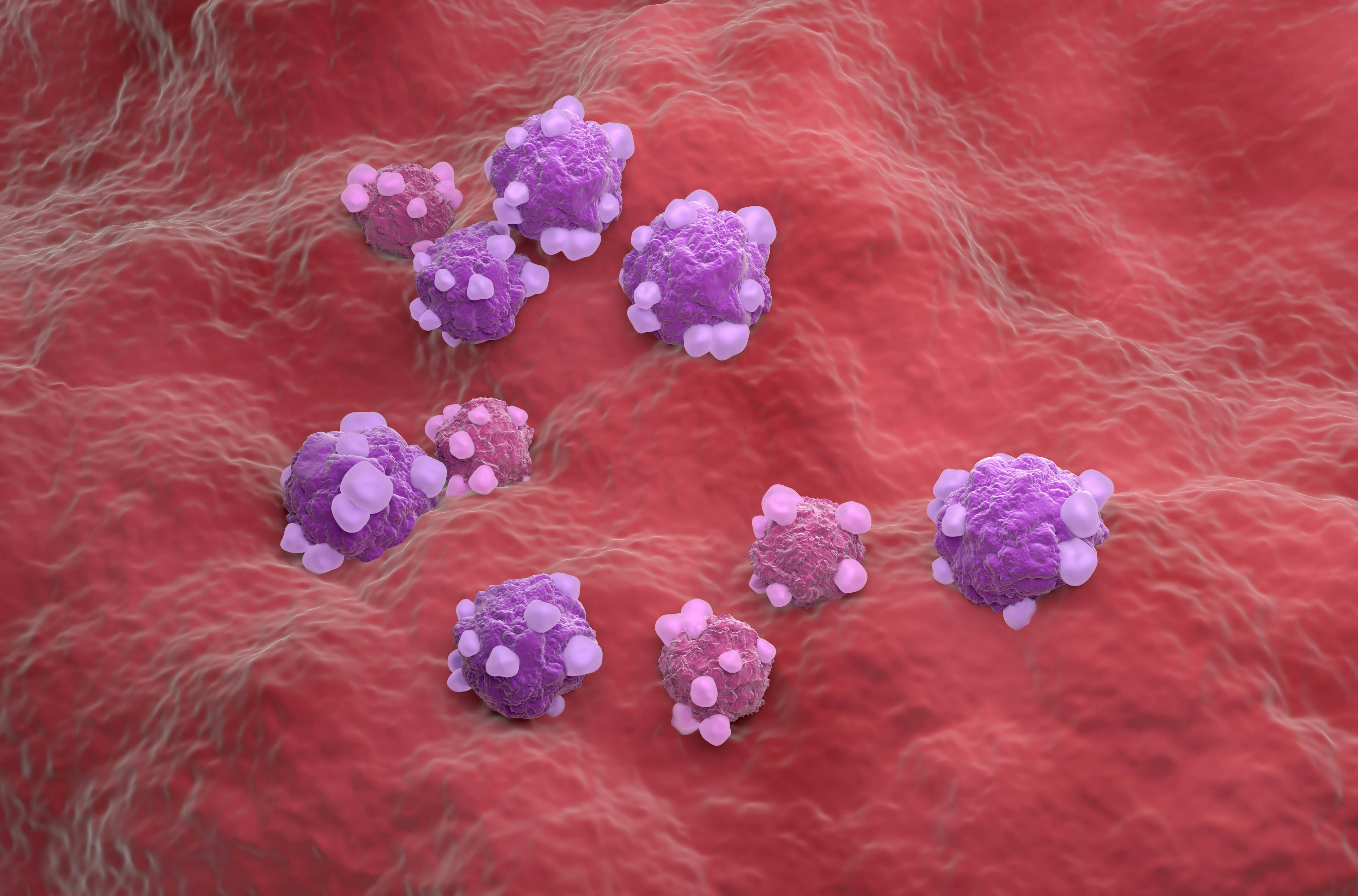 Ovarian cancer cell variations - isometric view 3d illustration | Image Credit: © LASZLO -www.stock.adobe.com