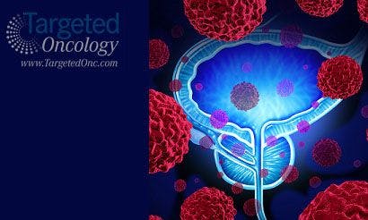 Atezolizumab Shows Tumor Reduction for Bladder Cancer in the Second Line 