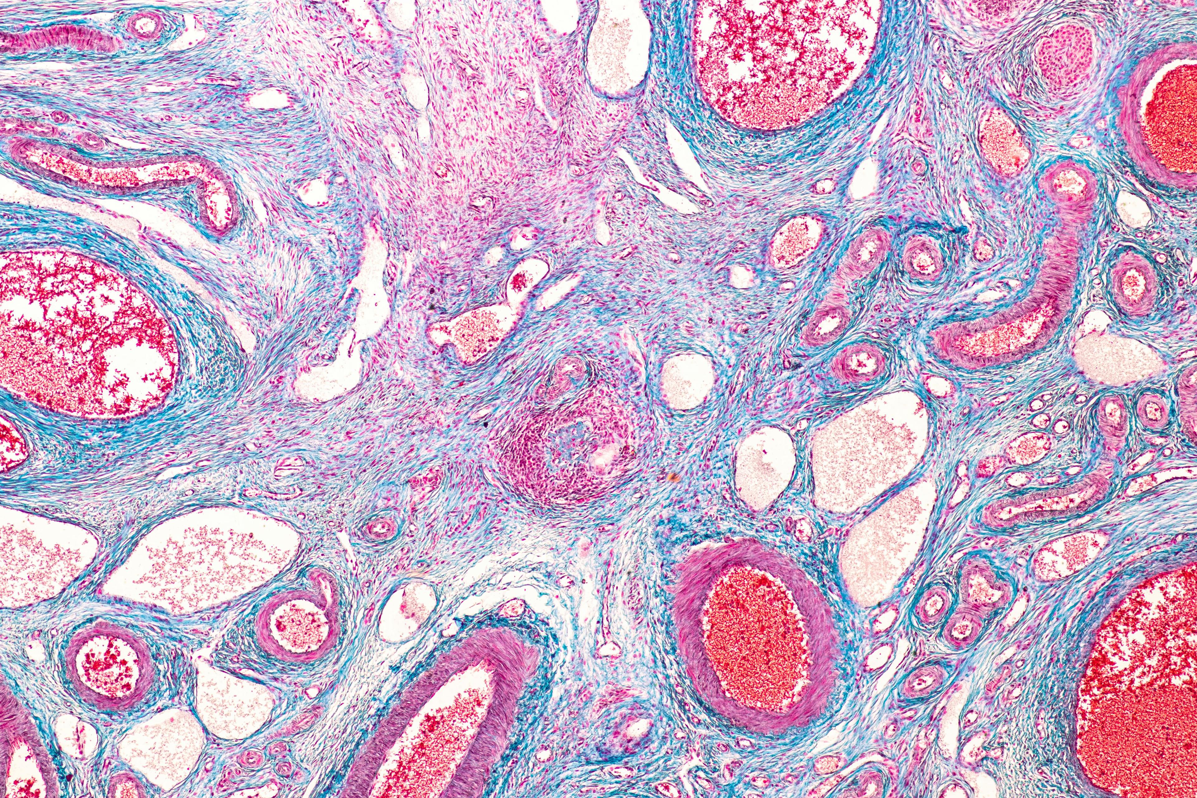 Ovary under the microscopic: © sinhyu - stock.adobe.com