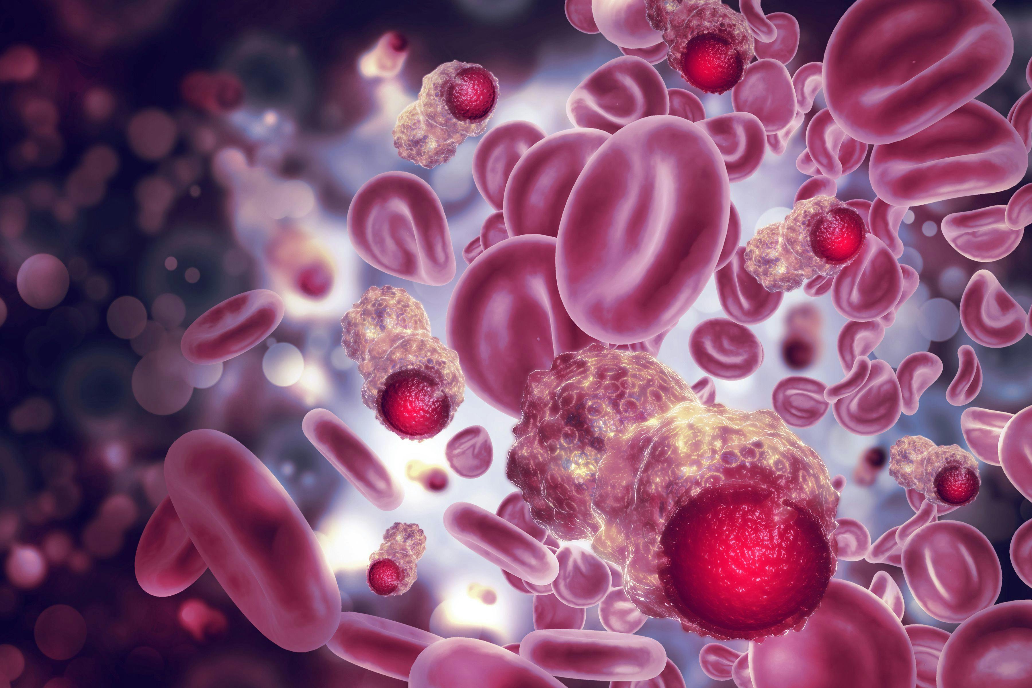 Cancer cells | Image Credit: © Crystal light - www.stock.adobe.com