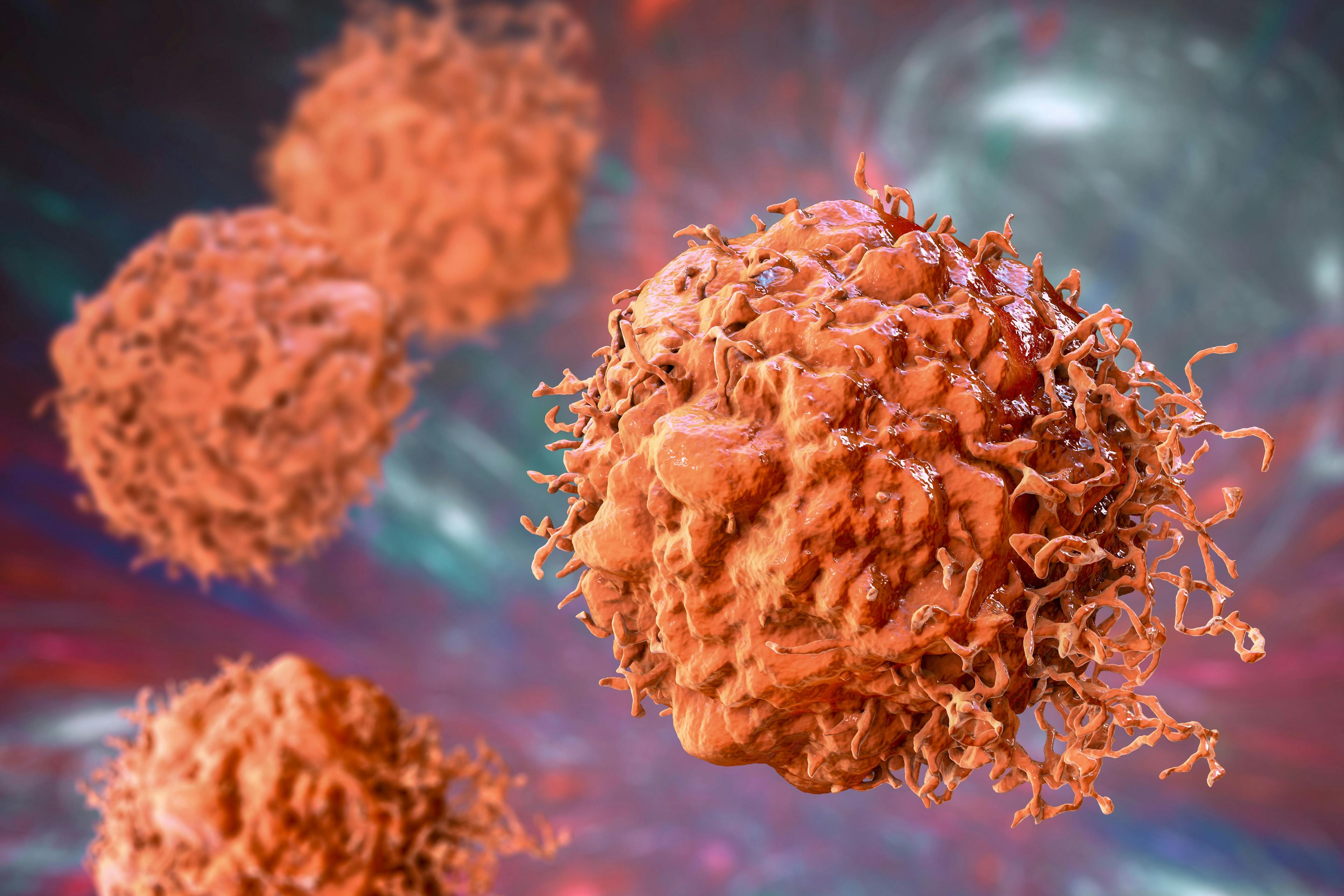 Cancer cells, 3D illustration | Image Credit: © Dr_Microbe - www.stock.adobe.com