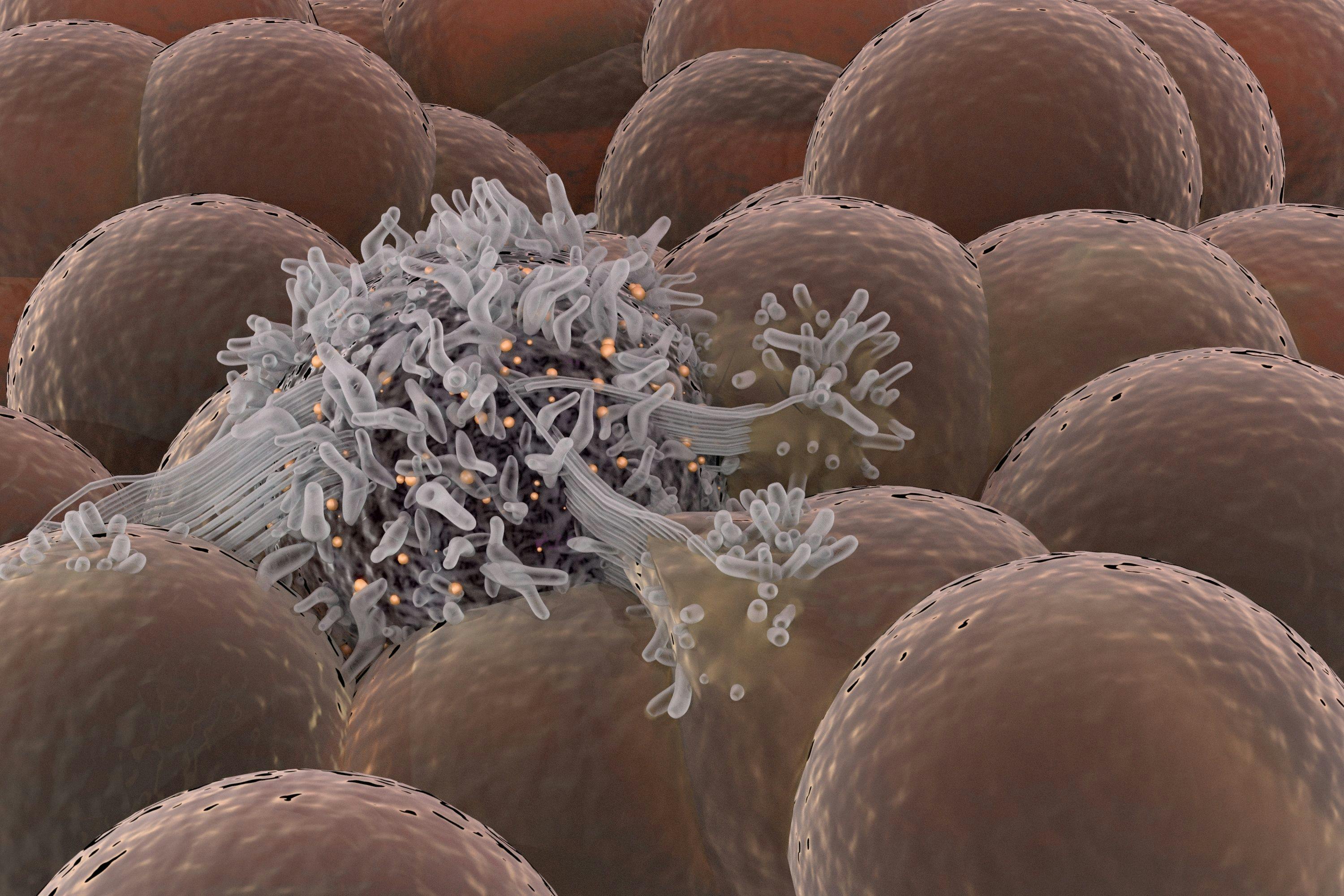 Cancer cell spreading among healthy cell stem cells© catalin - stock.adobe.com