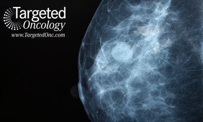 Final USPSTF Guidelines Reduce Breast Cancer Screening, Cause Debate Among Oncologists