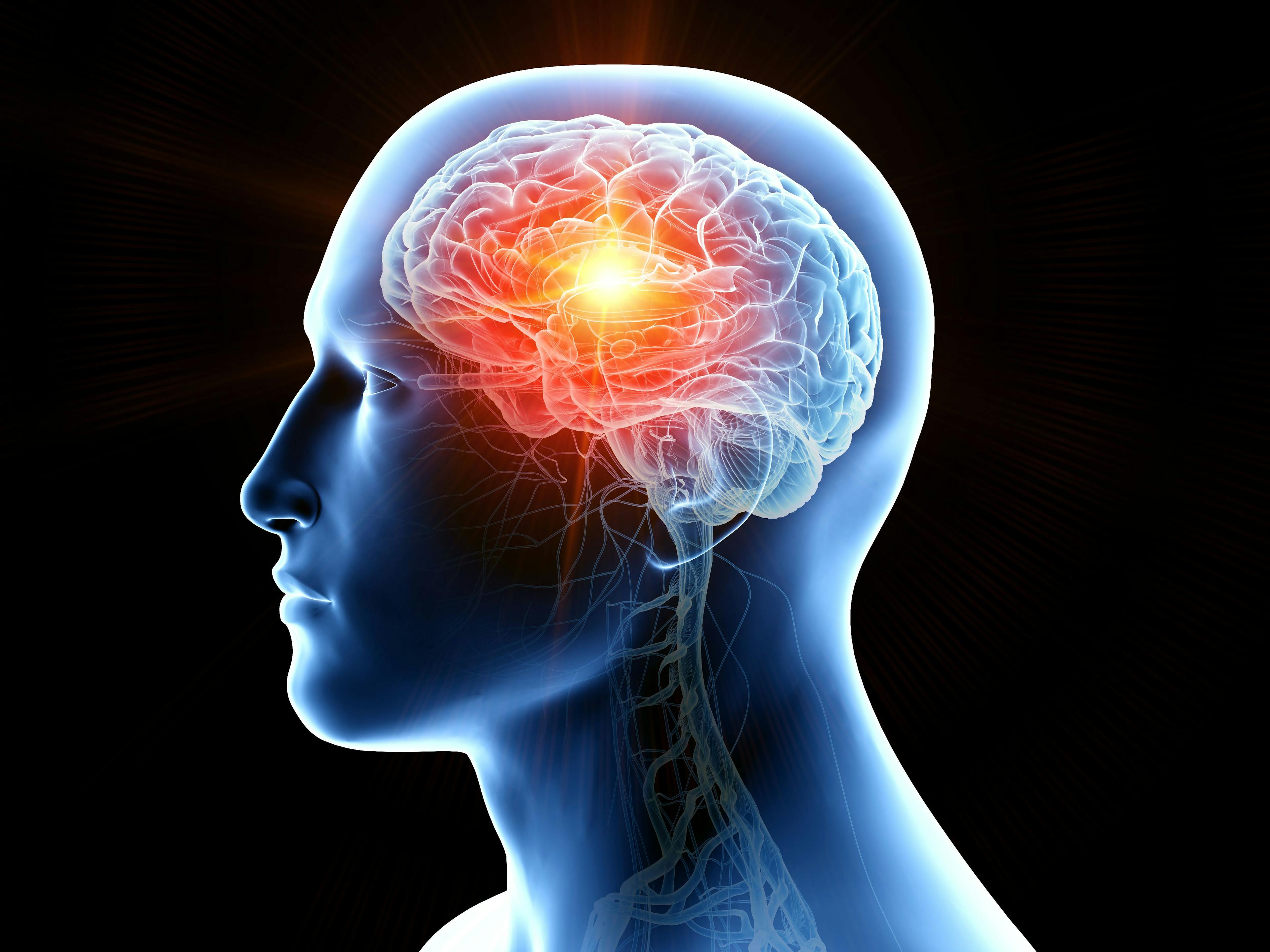 3D rendering of brain cancer: ©SciePro - stock.adobe.com