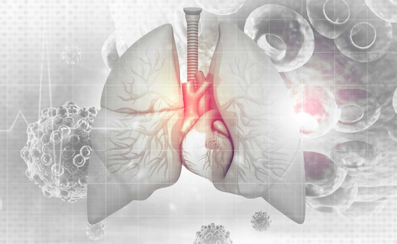 3D rendering of lung cancer