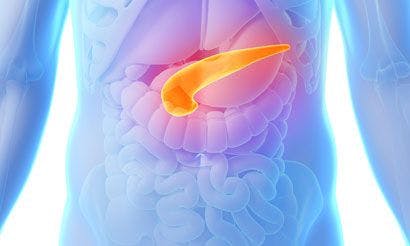 Whole-Genome Sequencing Identifies New Targets in Pancreatic Cancer