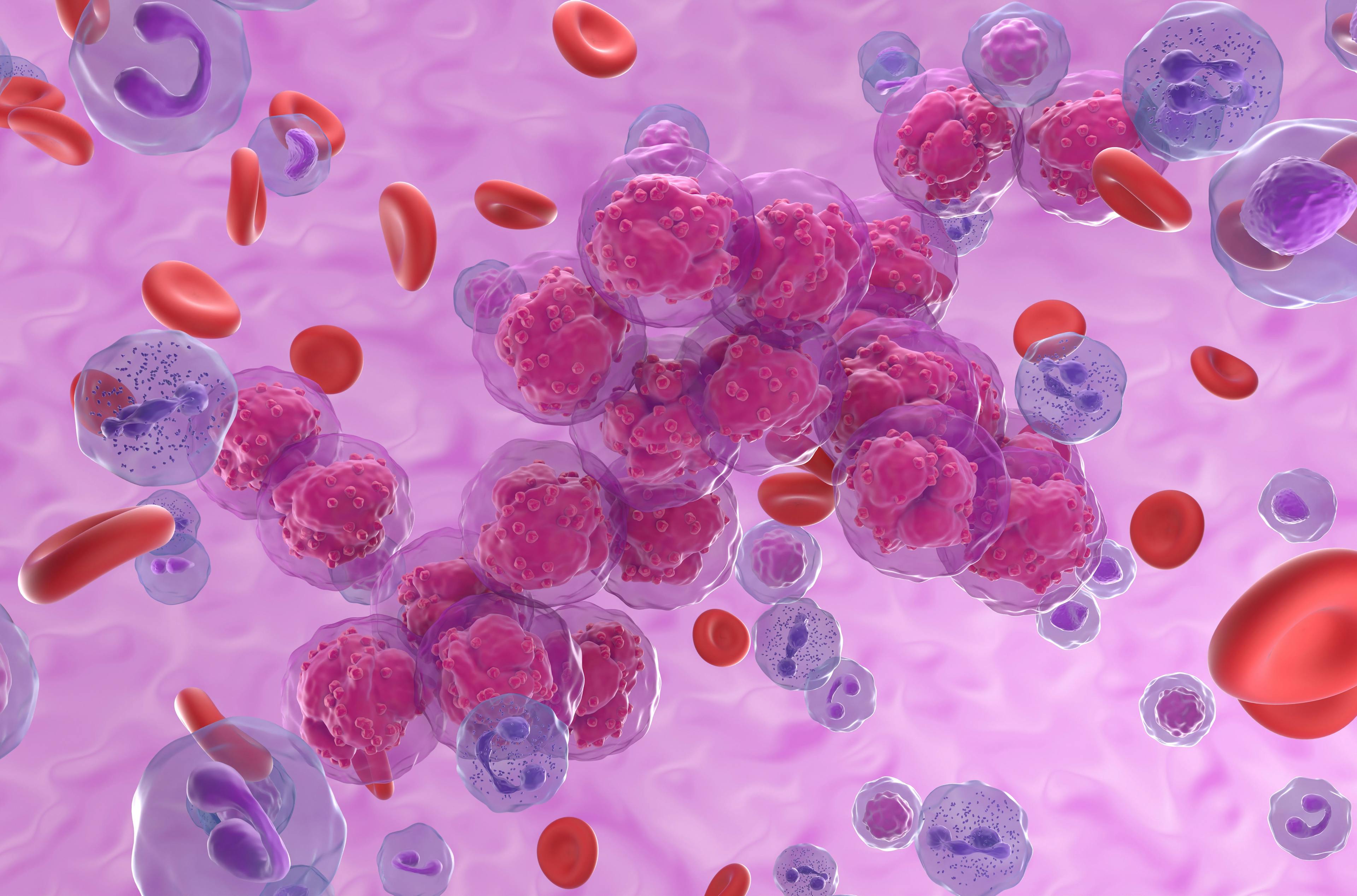 Acute lymphoblastic leukemia (ALL) cancer cell clusters in the blood flow - isometric view 3d illustration | Image Credit: © LASZLO - www.stock.adobe.com