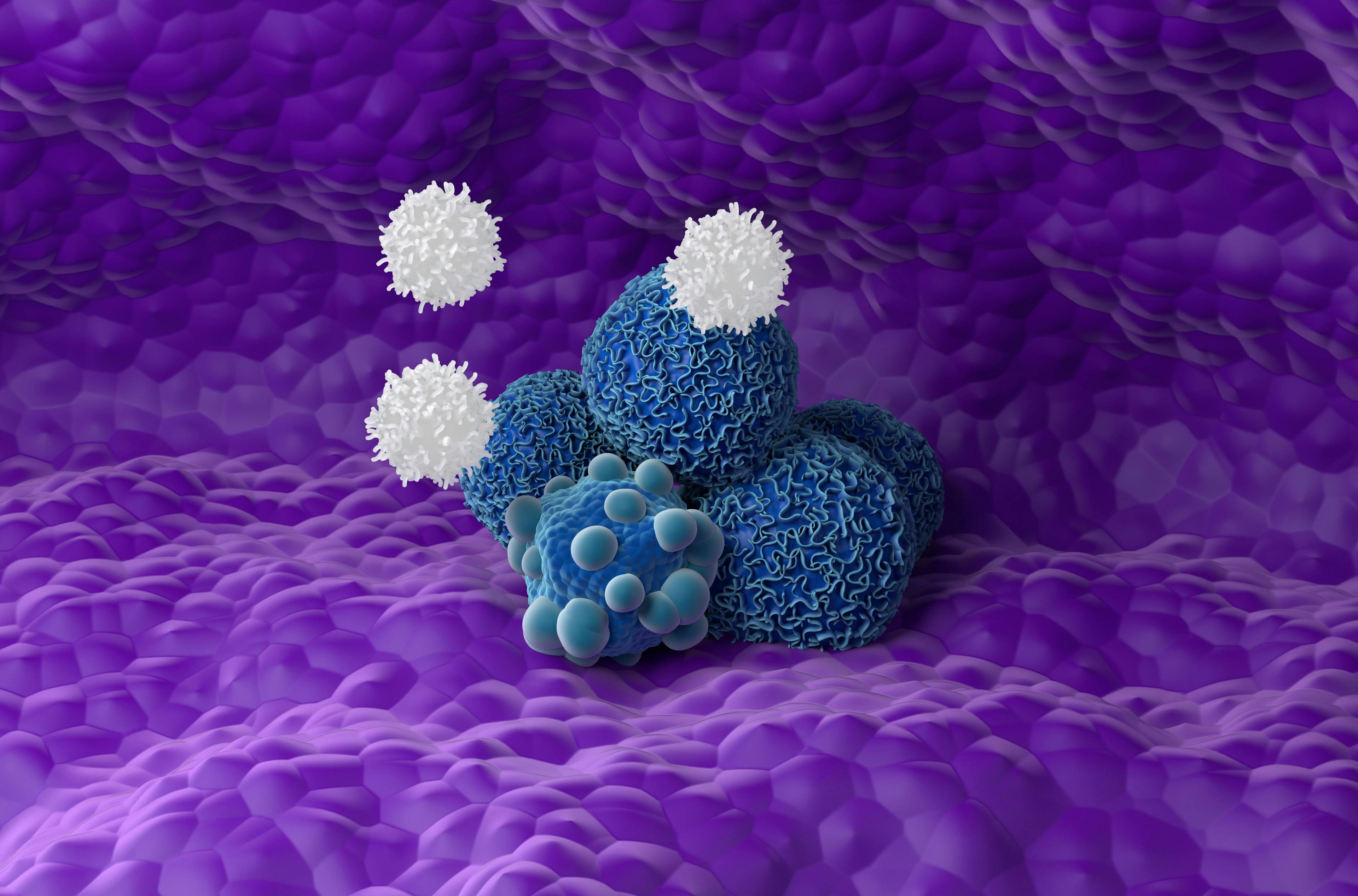 Activated t-cells attack pancreatic cancer cells group © LASZLO -www.stock.adobe.com