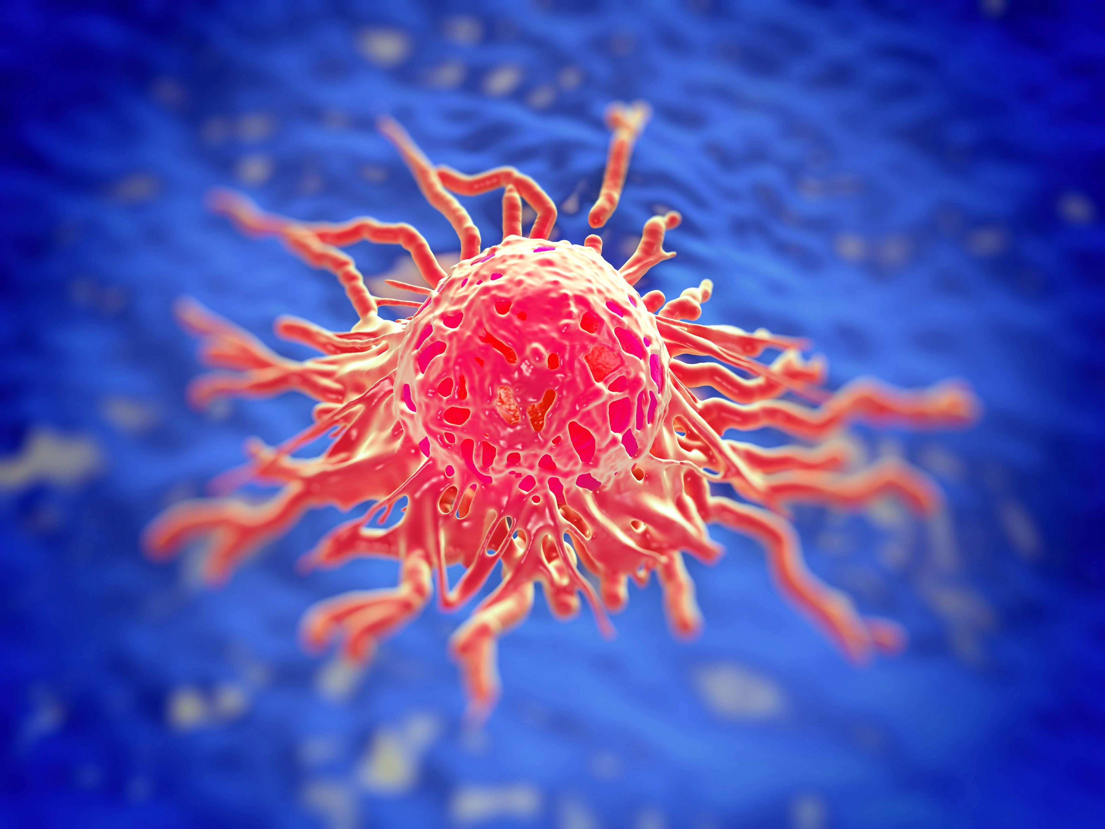 Cervical cancer cell, SEM of Cervical Carcinoma | Image Credit: © PRB ARTS - www.stock.adobe.com