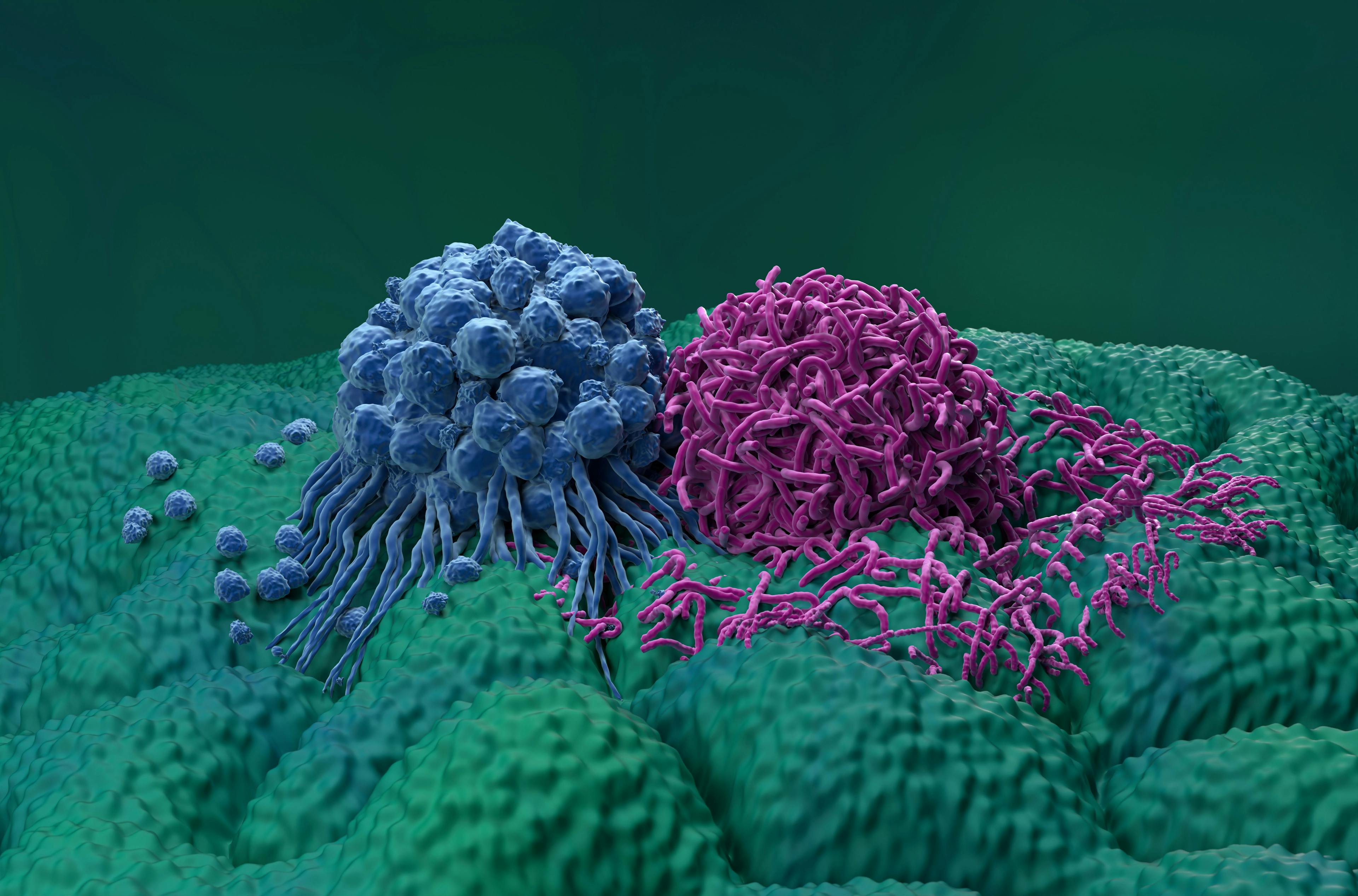 Gastric stomach cancer cells closeup view 3d illustration: © LASZLO - stock.adobe.com