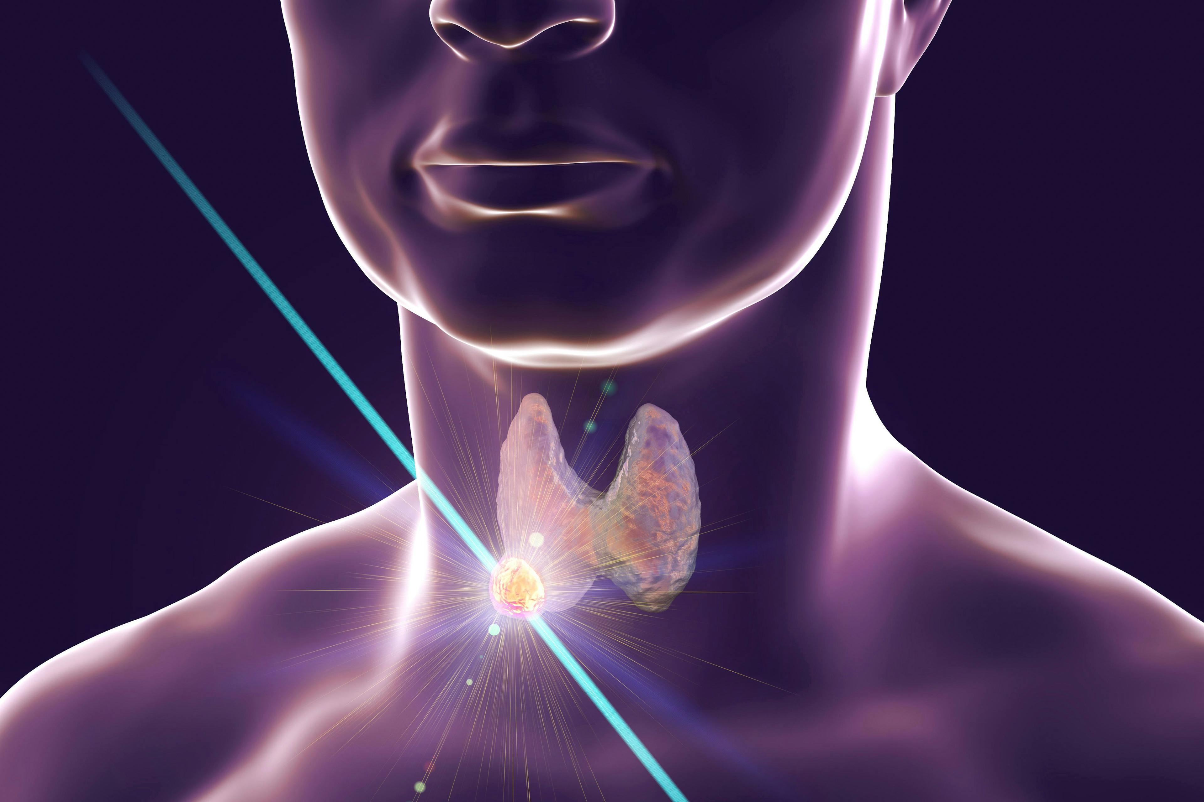 thyroid cancer, anaplastic thyroid cancer
