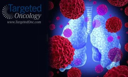 Nivolumab Granted Priority Review by the FDA for Nonsquamous NSCLC