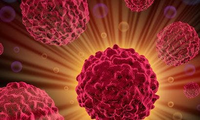 NDA Submitted for MM-398 With 5-FU and Leucovorin in Advanced Pancreatic Cancer
