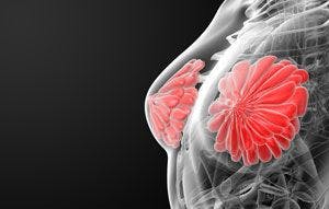 New research has identified a genetic variant that helps reduce the risk of breast cancer in some Latina patients by 40% to 80%.
